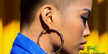 Understanding Hair Loss: Is Your Hairline Receding or Are These Signs of Alopecia?