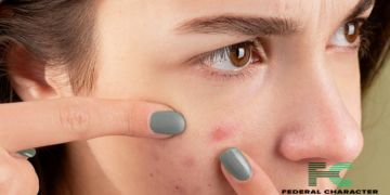 The Secret Message Behind Your Breakouts