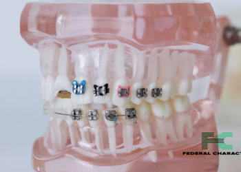 Crooked Teeth Don’t Have to Stay That Way! Your Guide to Fixing Crowding