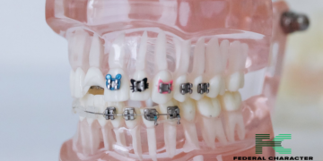 Crooked Teeth Don’t Have to Stay That Way! Your Guide to Fixing Crowding