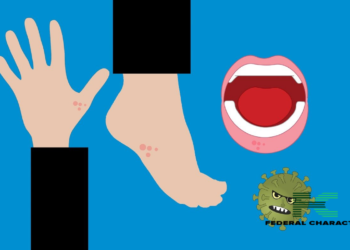 Natural Remedies for Soothing Chickenpox Itch