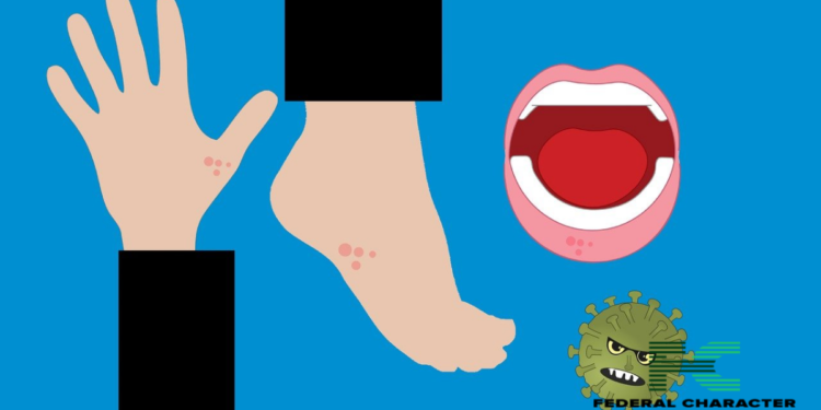 Natural Remedies for Soothing Chickenpox Itch