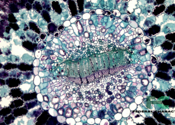 What Should Sickle Cell Patients Avoid?