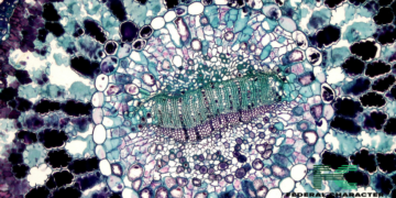 What Should Sickle Cell Patients Avoid?