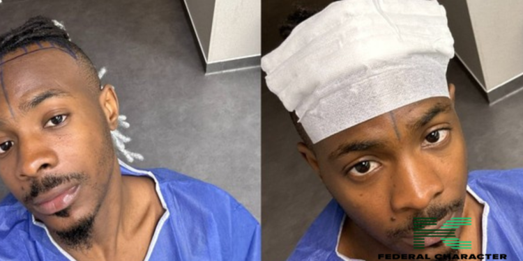 Young Jonn Reportedly Undergoes Hair Transplant Surgery
