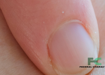 What’s The Color Of Your Fingernail Telling You?