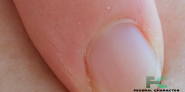 What’s The Color Of Your Fingernail Telling You?