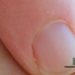 What’s The Color Of Your Fingernail Telling You?