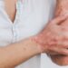 Psoriasis: What You Need to Know About This Skin Condition