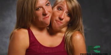 Abby and Brittany Hensel’s Extraordinary Lives As Conjoined Twins