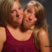 Abby and Brittany Hensel’s Extraordinary Lives As Conjoined Twins