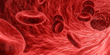 Hemophilia: Types, Symptoms and Treatment
