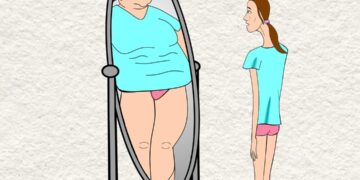 Anorexia Nervosa: Definition, Symptoms and Causes