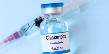 What’s the Difference: Measles vs. Chicken pox