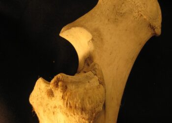 Bone Marrow And Its Essential