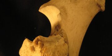 Bone Marrow And Its Essential