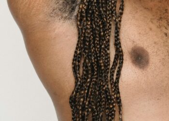 What Causes Hidradenitis Suppurativa (HS) To Smell Bad During Flare-ups?