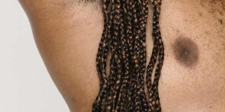 What Causes Hidradenitis Suppurativa (HS) To Smell Bad During Flare-ups?