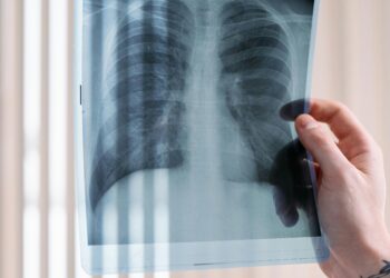 Are You Struggling to Breathe? Don’t Ignore These Signs of Asthma or COPD