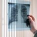 Are You Struggling to Breathe? Don’t Ignore These Signs of Asthma or COPD