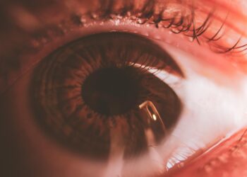 Types of Conjunctivitis and Their Symptoms