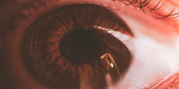 Types of Conjunctivitis and Their Symptoms