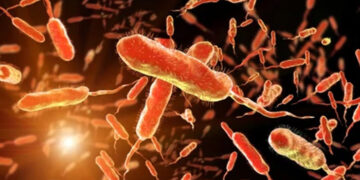 Cholera Outbreak in Ogun State – 25 Cases Confirmed, One Death Reported