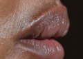 Pucker Up: Lip Care 101 for Irresistible Kissers