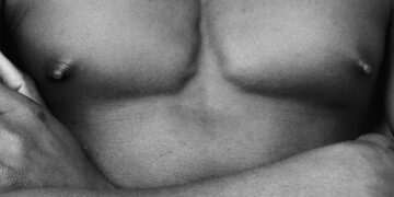 Are You Struggling with Man Boobs? Here Are 5 Proven Ways to Get Rid of It