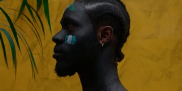 All Women Have Facial Hair! But What Could Cause An Excess in Chin Hair?