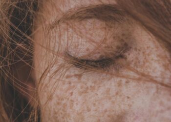 LEOPARD Syndrome (NSML): Symptoms, Causes, and Treatment