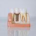 Top 4 Ways to Whiten Yellow Teeth & Restore Translucency