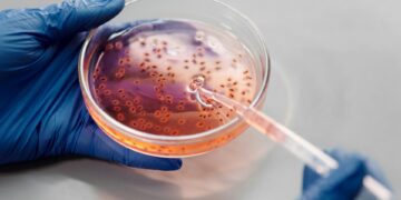“Flesh-Eating Bacteria” on the Rise in 2024: What You Need to Know