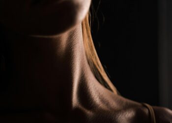 Get Rid of Neck Hyperpigmentation for a Younger-Looking You!