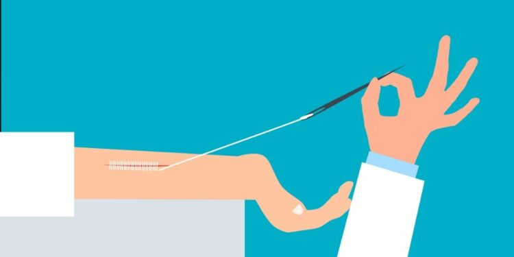 6 Effective Ways To Stop Keloids From Growing