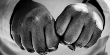 The Root of Knuckle Pads: What Causes Knuckle Pads?