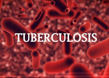 Nigeria Requests a $25 million Private Sector Investment to Fight Tuberculosis