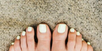 5 Simple Solutions for Straightening a Bent Big Toe