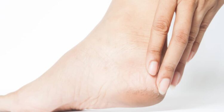 Easy Fixes For Dry Feet