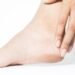 Easy Fixes For Dry Feet