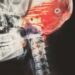 CSF Cerebrospinal Fluid: The Liquid Cushioning Your Brain