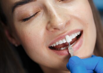 To Get Veneers or Not? What You Need to Know Before Making a Choice
