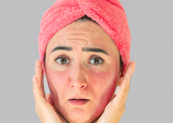 Lupus: What Are the Signs and Symptoms You Should Know?