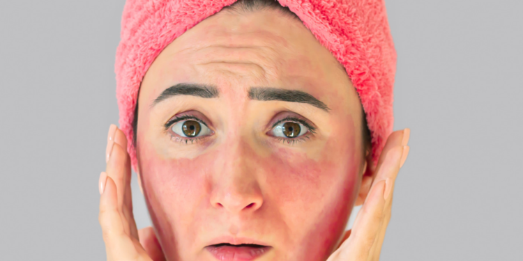 Lupus: What Are the Signs and Symptoms You Should Know?