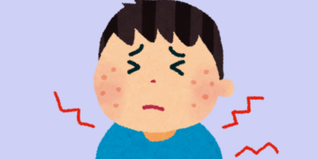 Shingles (Herpes Zoster): Symptoms, Causes, and Risk Factors