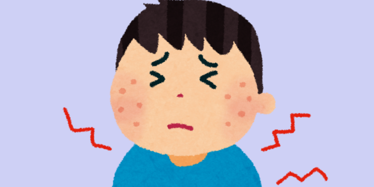 Shingles (Herpes Zoster): Symptoms, Causes, and Risk Factors