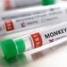 Three Cases of Monkeypox Recorded in Edo State