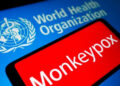 Ivory Coast Joins the Mpox Clade 2 Club