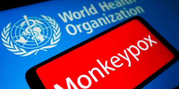 Ivory Coast Joins the Mpox Clade 2 Club