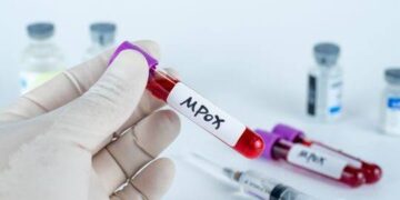 Mpox: FG Increases Border Measures Due to Worldwide Outbreak